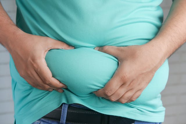 7 Langkah Mencegah Obesitas Agar Hidup Lebih Bahagia